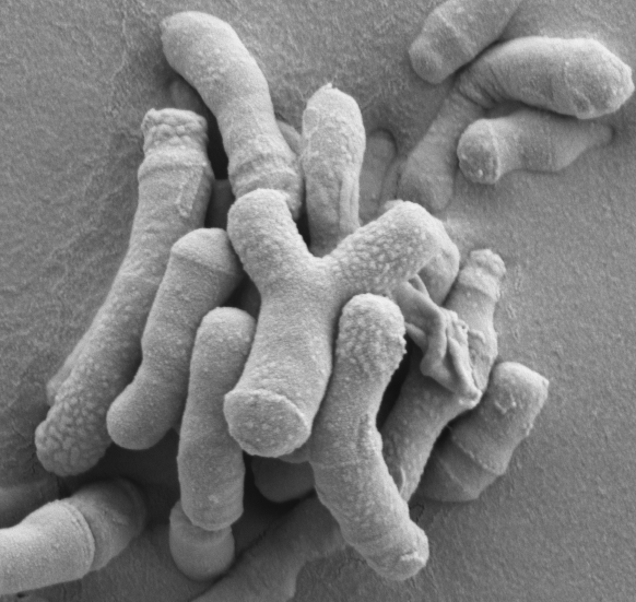 16-003 B. breve UCC2003_06_cropped