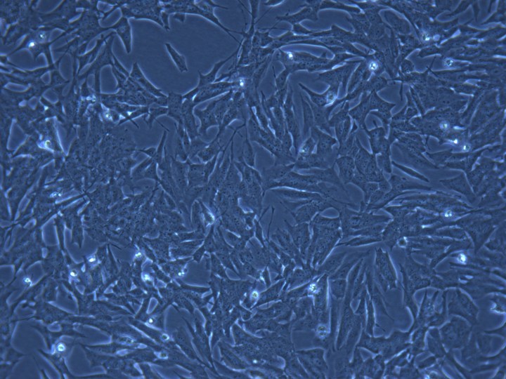 Neuronal cells grown in culture